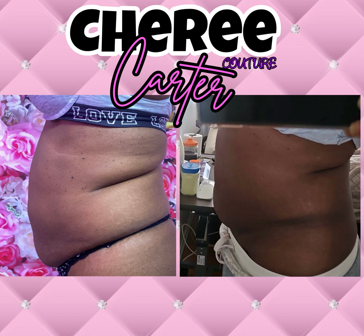 Hot Shot Liquid Lipo Studio Injections