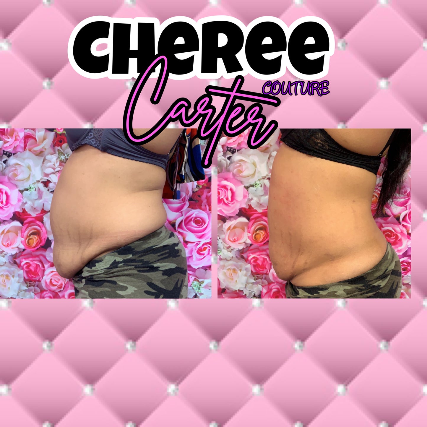 Needle-Free Liquid Lipo Shots