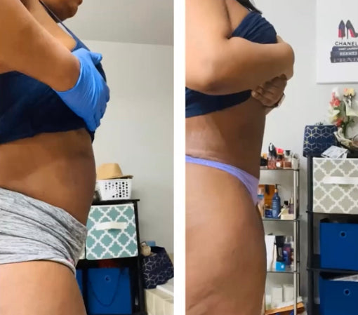 Baddie Juice Skinny Shot Injections