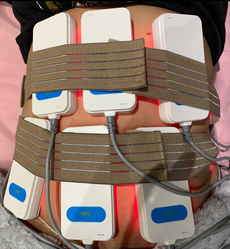 Laser Lipo