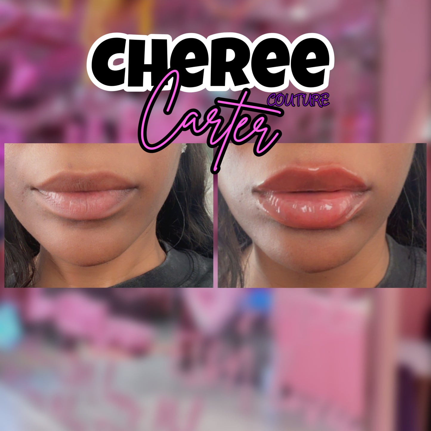 Lip Shots Lip Plumping Gloss